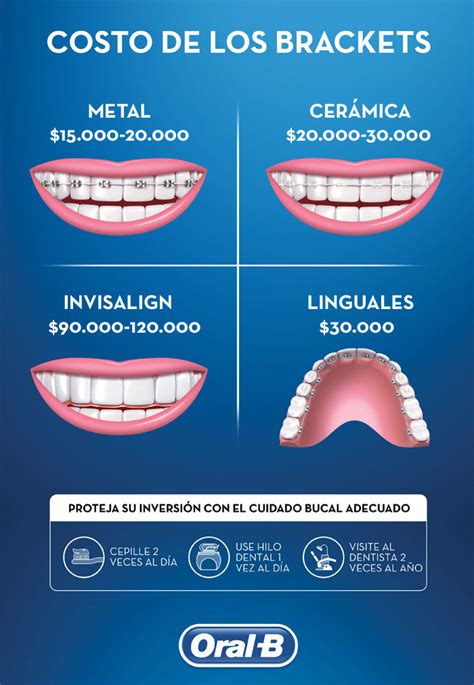 precio para poner brackets